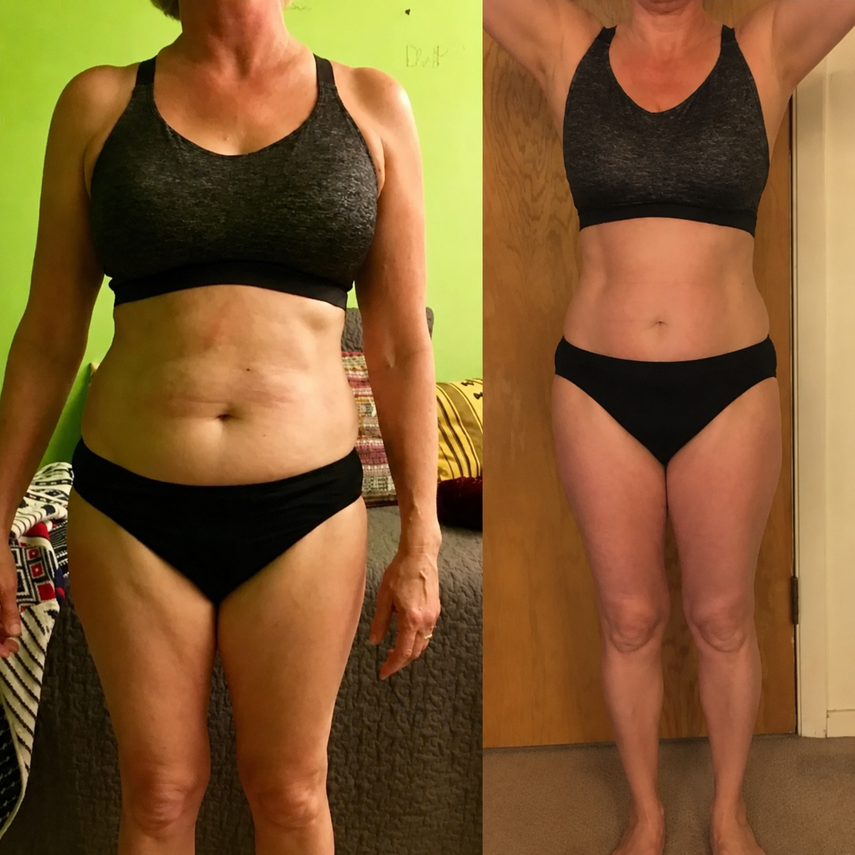 Orvano LumaCore Pro™ Red Light Therapy Belt